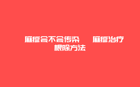 荨麻疹会不会传染 荨麻疹治疗根除方法